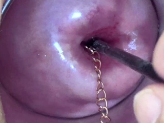 Extreme Asian Cervix Playing With Chain In Uterus...